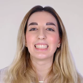Corectarea Asimetriei Cauzate de Închiderea Incorectă a Spațiilor