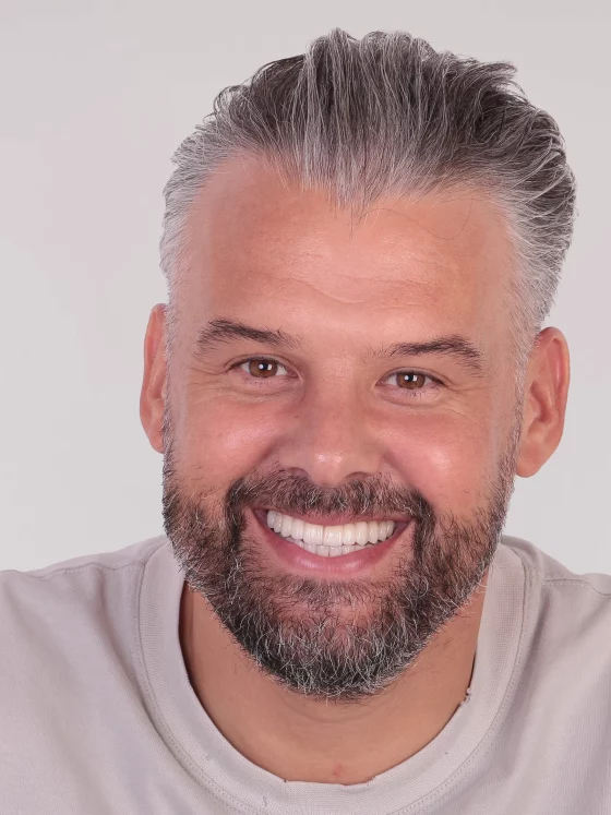 Reabilitare totală