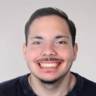 Zâmbet gingival: corecție ortodontică fără chirurgie