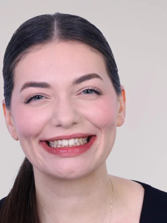 Zâmbet gingival: corecție ortodontică fără chirurgie