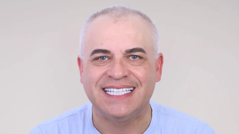 Reabilitare completă prin tratament parodontal, ortodonție, implanturi și restaurări protetice